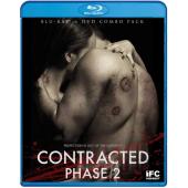 4GBD255510 神秘感染：第二阶段